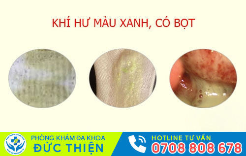 Khí hư màu xanh có bọt