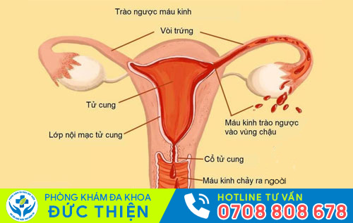 Kinh nguyệt không đều kéo dài có thể là do bệnh phụ khoa gây nên