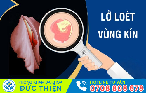 Lở loét vùng kín do bệnh lý