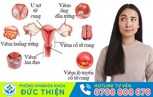 Một số bệnh phụ khoa thường gặp ở nữ giới