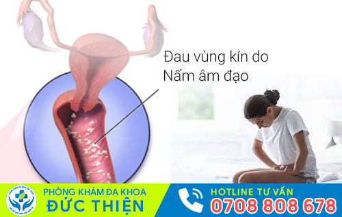 Đau vùng kín là dấu hiệu của nấm âm đạo