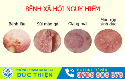 Nguyên nhân âm đạo có mùi