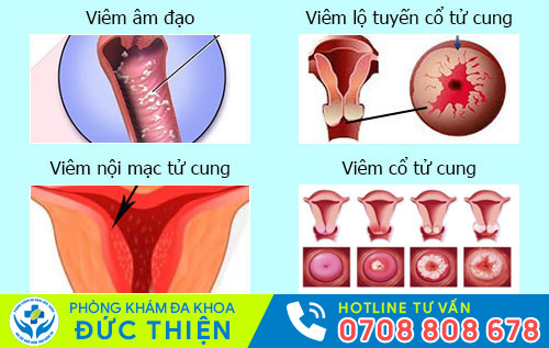 Nguyên nhân chậm kinh ra máu