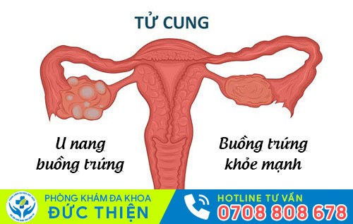 Nguyên nhân đau rát khi quan hệ