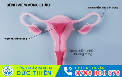 Nguyên nhân gây đau bụng dưới