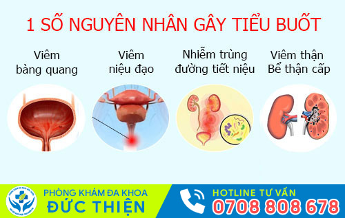 Nguyên nhân gây tiểu buốt