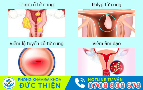 Nguyên nhân ra máu khi quan hệ
