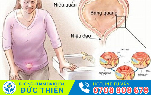 Nguyên nhân tiểu đêm nhiều lần