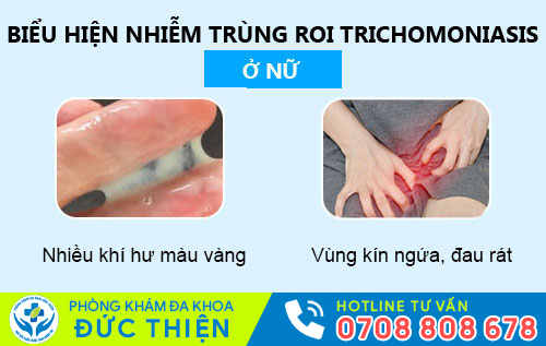 Nhiễm trichomonas ở nữ giới