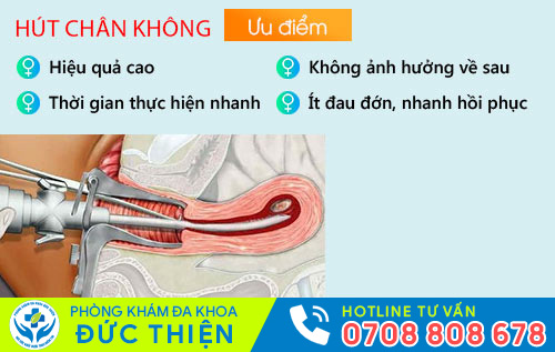 Bỏ thai 2 tháng bằng cách hút thai