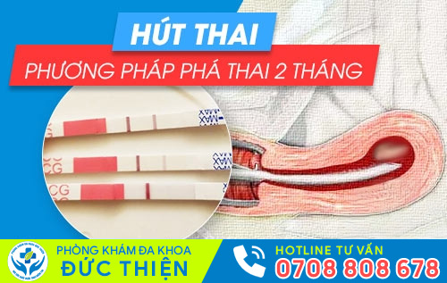 Hút thai – phương pháp phá thai 2 tháng an toàn