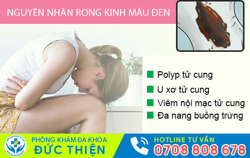 Rong kinh máu đen