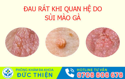 nguyên nhân đau rát khi quan hệ