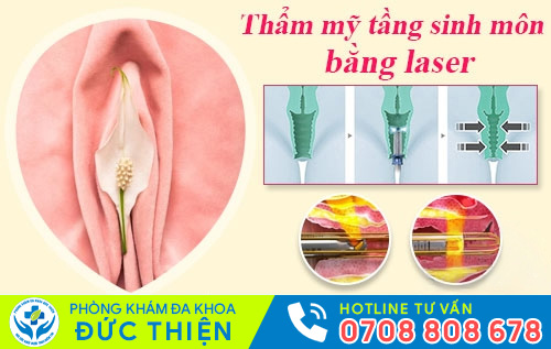 Thẩm mỹ tầng sinh môn bằng phương pháp Laser