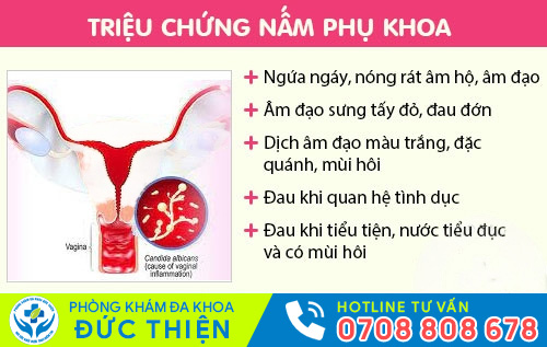Triệu chứng nấm phụ khoa