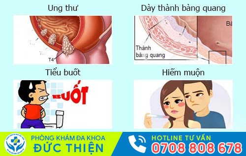 Tác hại của viêm bàng quang