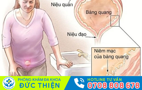 Viêm đường tiết niệu nữ gây ra nhiều biến chứng nguy hiểm