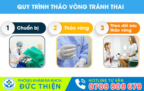 Quy trình tháo vòng tránh thai