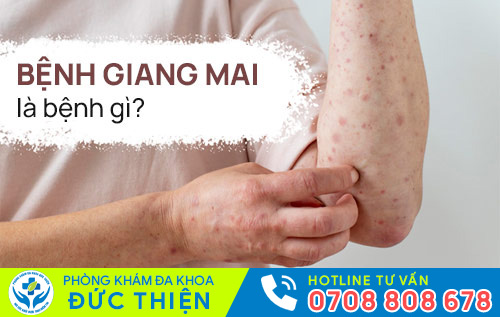 benh giang mai la benh gi