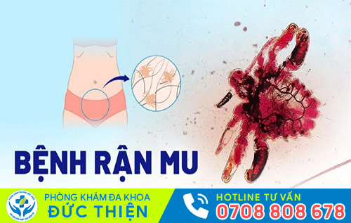 Thuốc hỗ trợ điều trị rận mu hiện nay