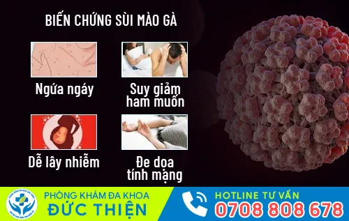 bien chung nguy hiem cua sui mao ga