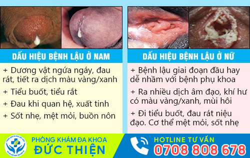 Biểu hiện của bệnh lậu
