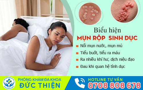 Biểu hiện mụn rộp sinh dục