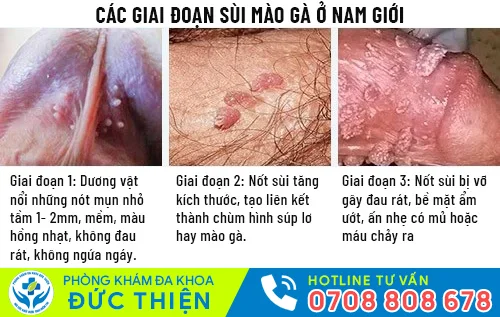 cac giai doan sui mao ga o nam gioi