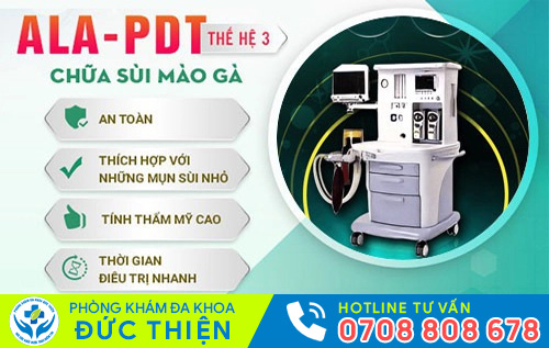 Phương pháp chữa gai sinh dục hiệu quả
