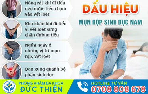 Biểu hiện mụn rộp sinh dục ở nam