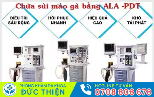 Đốt điện là phương pháp điều trị sùi mào gà hiệu quả hiện nay