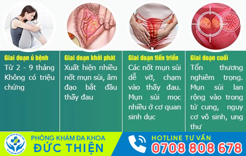 Sùi mào gà ở nữ có thời gian ủ bệnh ngắn hơn