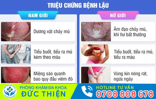 Bệnh lậu cần được điều trị càng sớm càng tốt