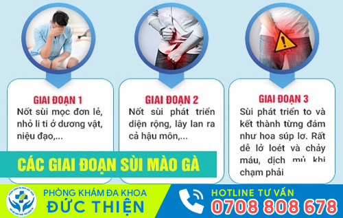 Hình ảnh bệnh nhân bị sùi mào gà ở dương vật