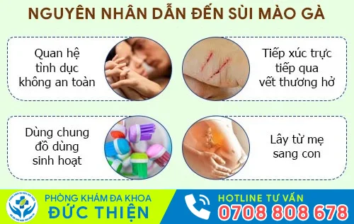 nguyen nhan sui mao ga