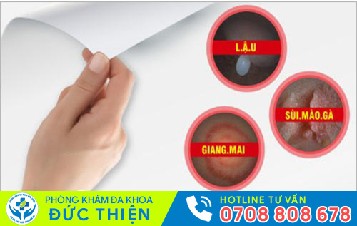Phương pháp chữa chuỗi hạt ngọc dương vật hiệu quả