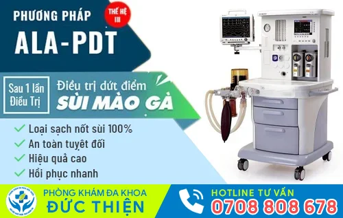phuong phap dot dien cai tien moi dieu tri sui mao ga