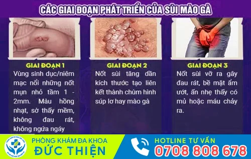 sui mao ga nam gioi