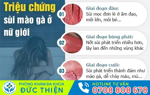 sui mao ga o nu gioi