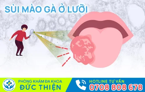 sui mao ga o luoi
