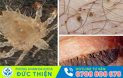 Rận mu có tốc độ sinh sản rất nhanh