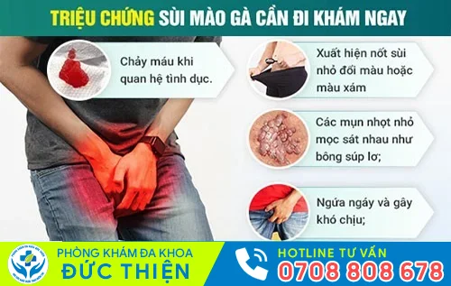 trieu chung sui mao ga can di kham ngay