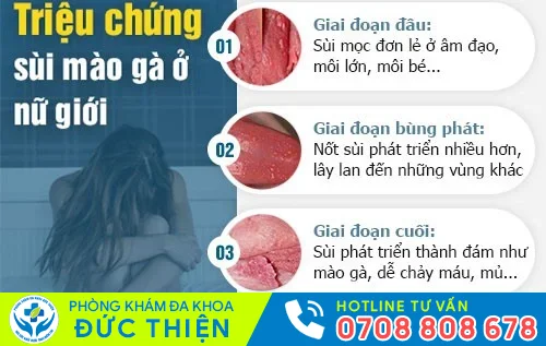 trieu chung sui mao ga o nu gioi